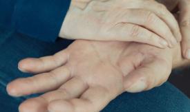 Scene from the film Hands, trees, heads, scars