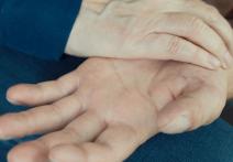 Scene from the film Hands, trees, heads, scars